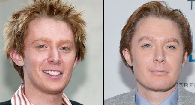 Clay Aiken before and after plastic surgery