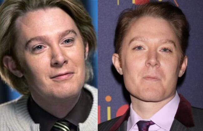 Clay Aiken plastic surgery before and after 2