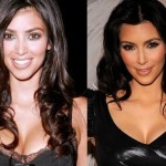 Kim Kardashian before after plastic surgery 2006 2010 150x150