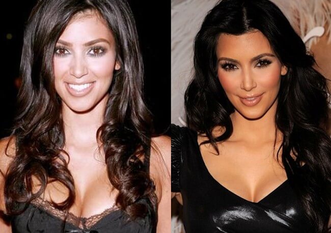 Kim Kardashian before after plastic surgery 2006 2010