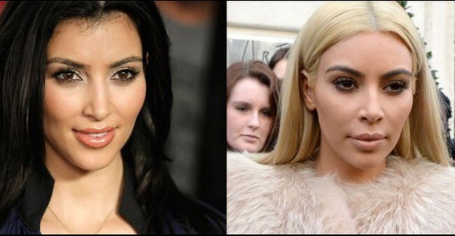 Kim Kardashian before after plastic surgery 4
