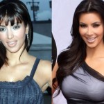 kim kardashian before after plastic surgery 2 150x150