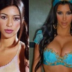 kim kardashian before after plastic surgery 2001 2009 150x150