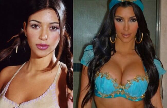 kim kardashian before after plastic surgery 2001 2009