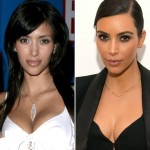 kim kardashian before after plastic surgery 2005 2014 150x150