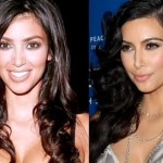 kim kardashian before after plastic surgery 5 150x150